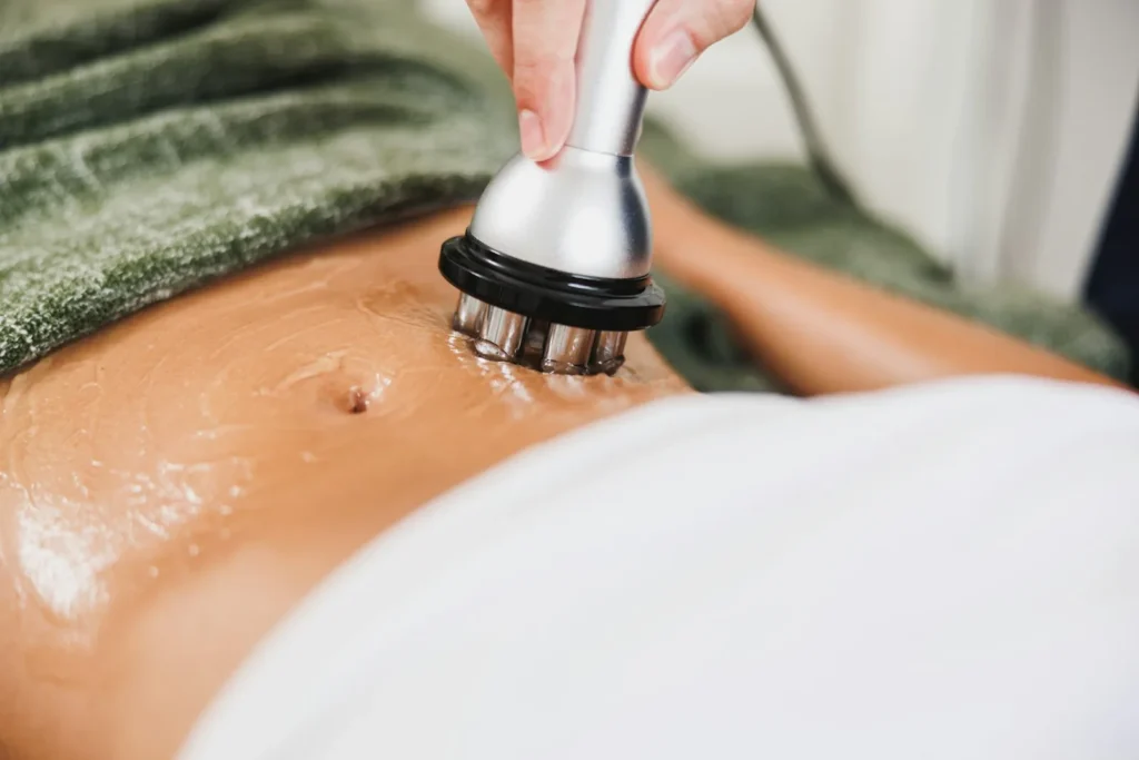 Aplicación de un cabezal de tratamiento sobre la zona abdominal