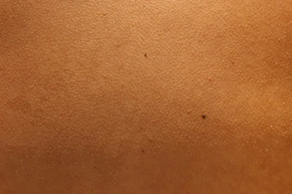 Detalle de la piel en primer plano